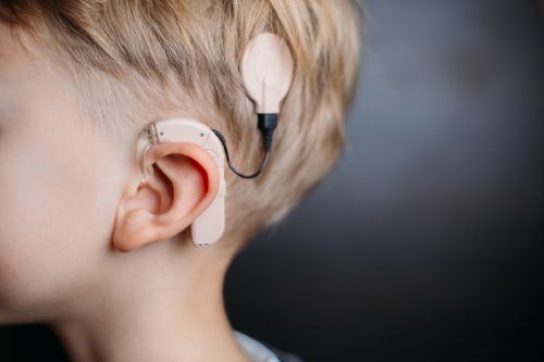 Cochlear Implants Bend Redmond Oregon